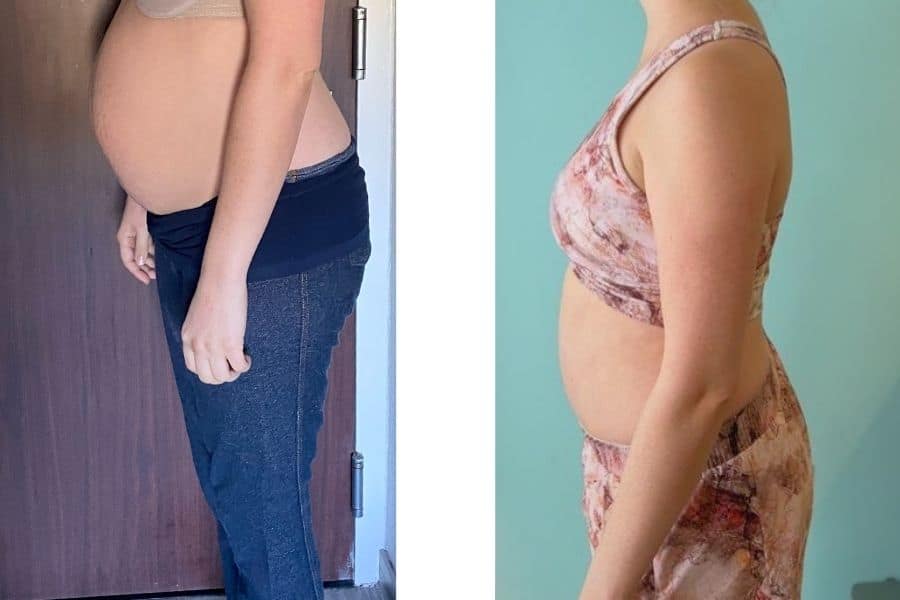 https://evidence-basedmommy.com/wp-content/uploads/2022/02/before-and-after-tummy-tuck-3-months-post-op.jpg